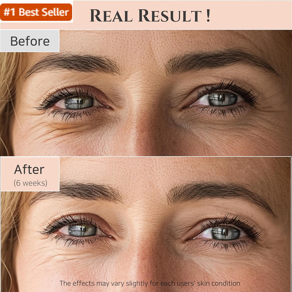 Beauty of Joseon Revive Eye Serum with Retinal Niacinamide Correction for Puffy